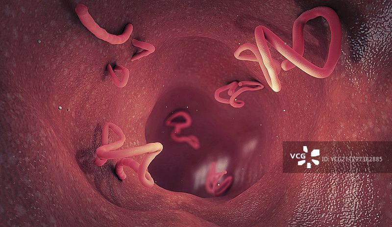 人肠道内的绦虫感染插图图片素材