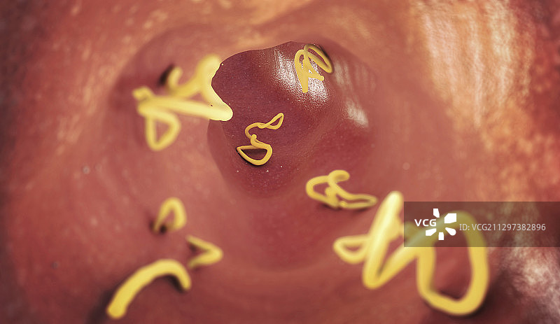 人肠道内的绦虫感染插图图片素材