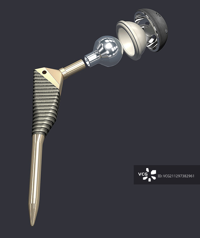 髋关节假体插图图片素材