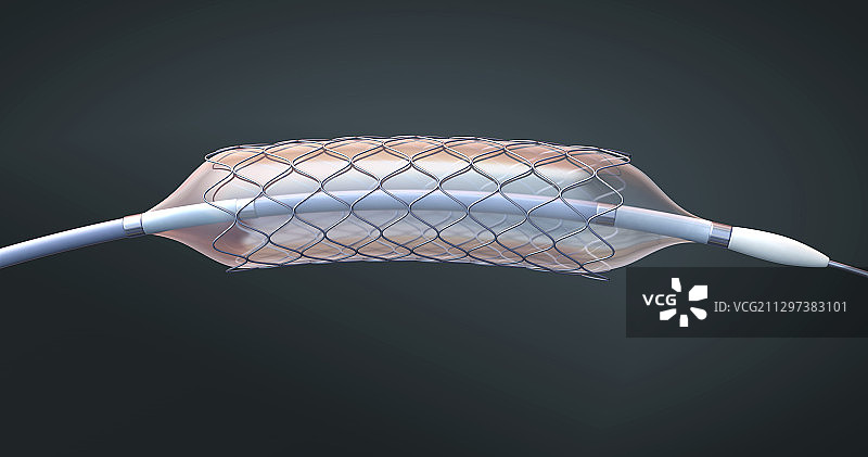 支架和球囊导管插图图片素材