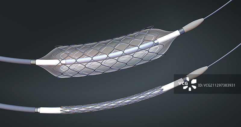 支架和球囊导管图示图片素材