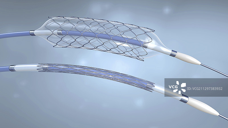 支架和球囊导管图示图片素材
