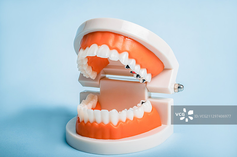 刷牙世界爱牙日牙齿健康保护清洁卫生洗牙龋齿坏牙图片素材