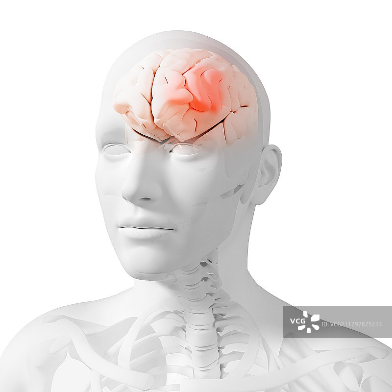 头痛，概念艺术作品图片素材