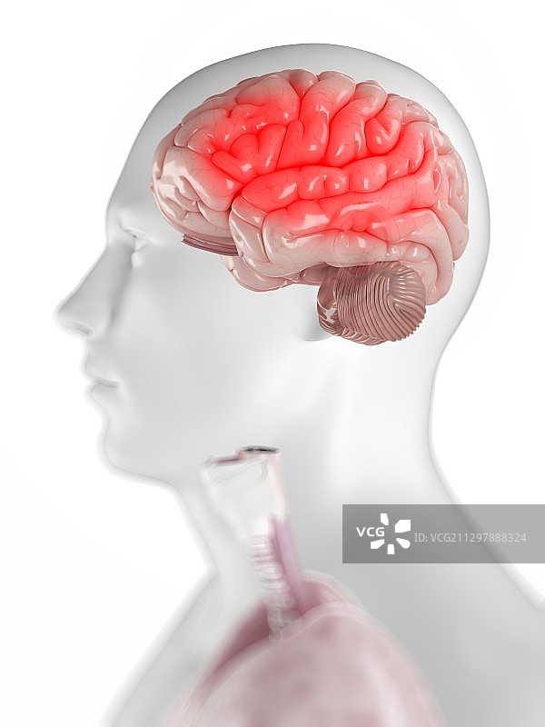 头痛，概念艺术作品图片素材