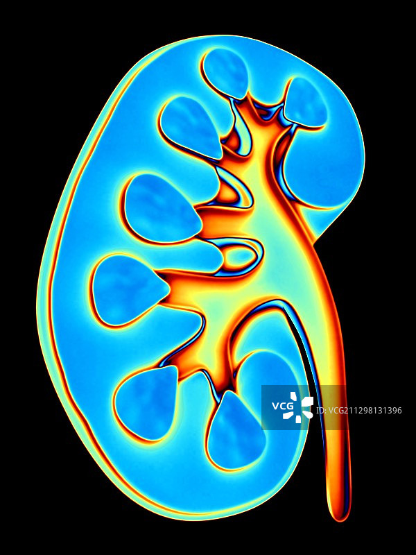 人类肾脏切面电脑图图片素材