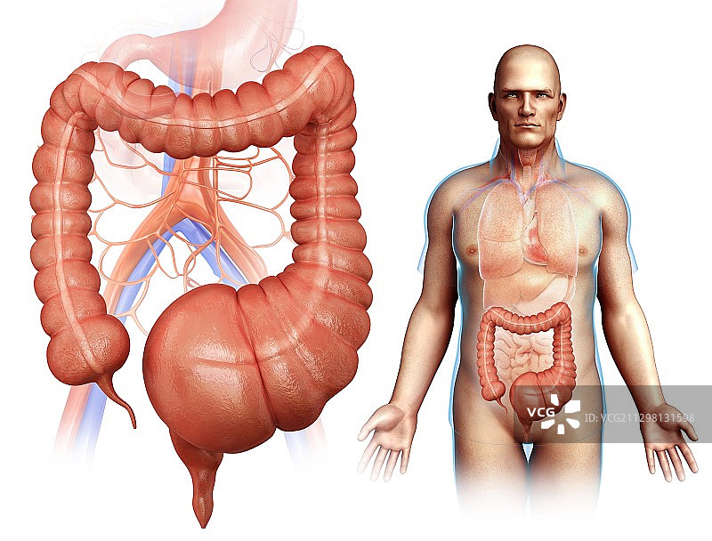 巨结肠插画图片素材