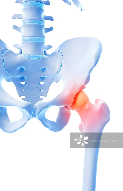 人的髋部疼痛图片素材