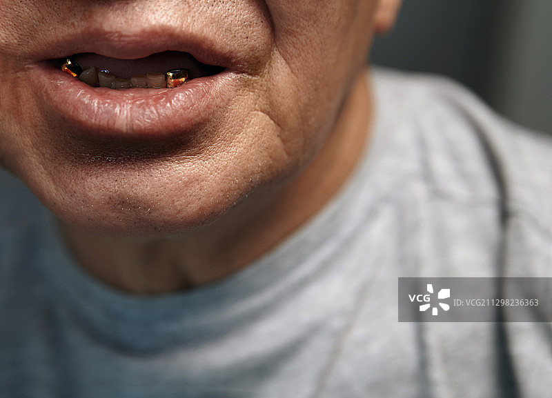 一位牙齿不好的老年男人的嘴部图片素材
