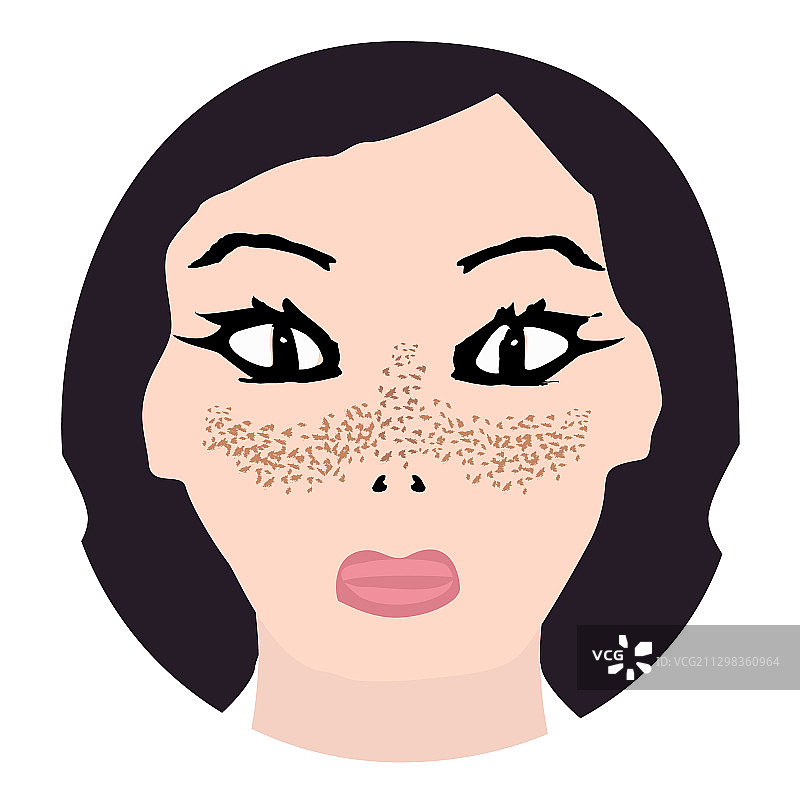 皮肤上的雀斑色素沉淀图片素材