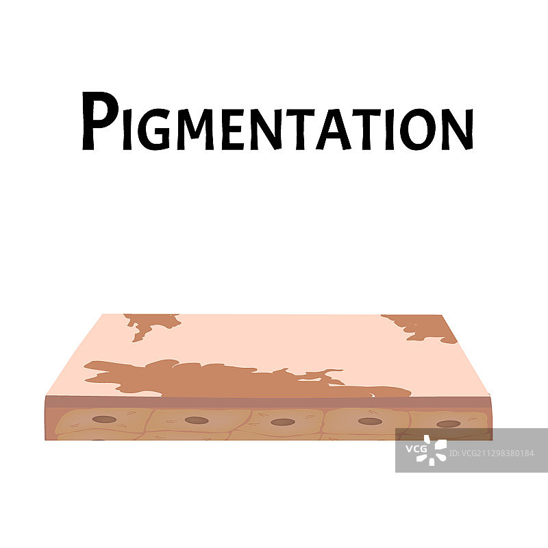 皮肤色素沉淀图片素材