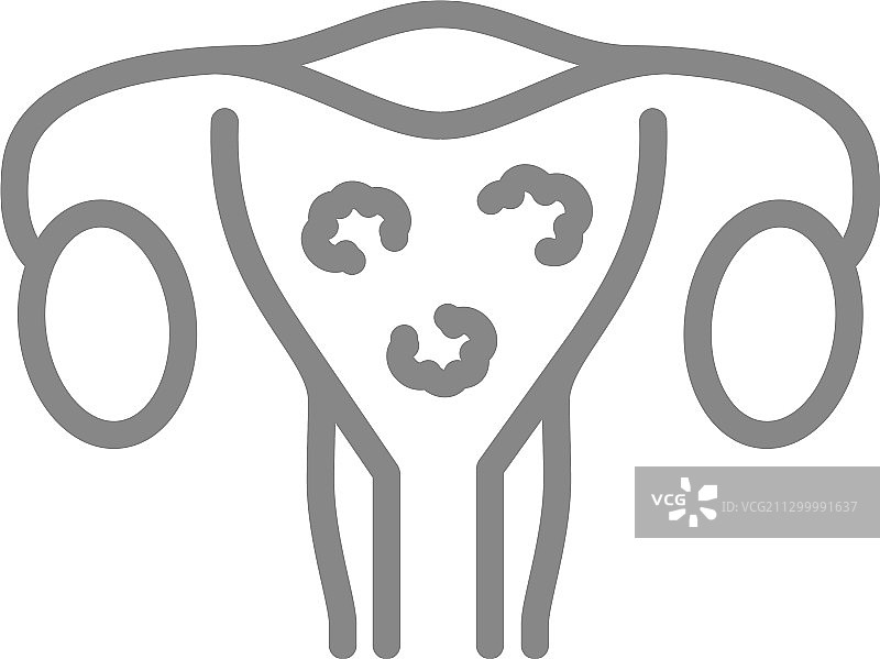 子宫内有肿瘤线象病变图片素材