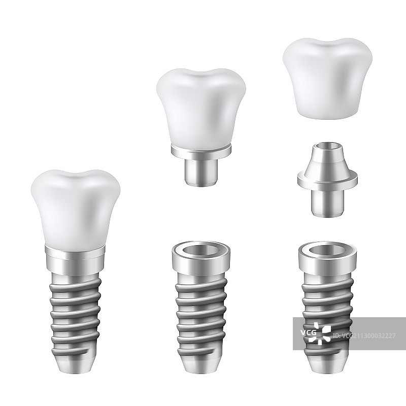 牙科植入物套装医疗和牙医图片素材