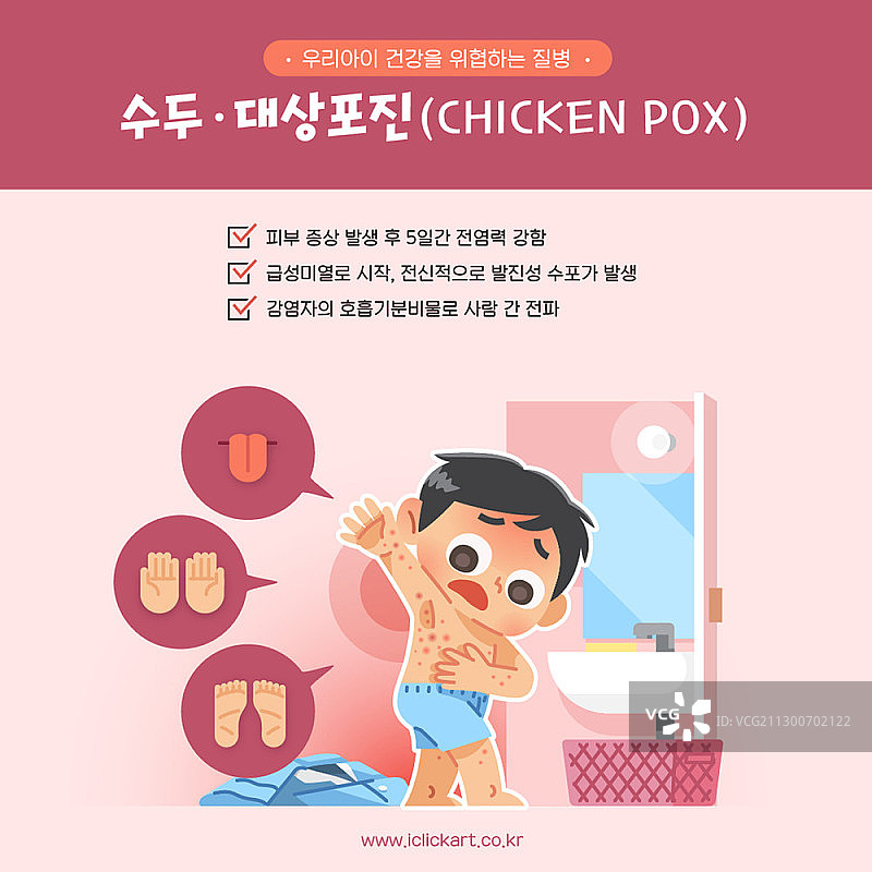 水痘矢量图图片素材
