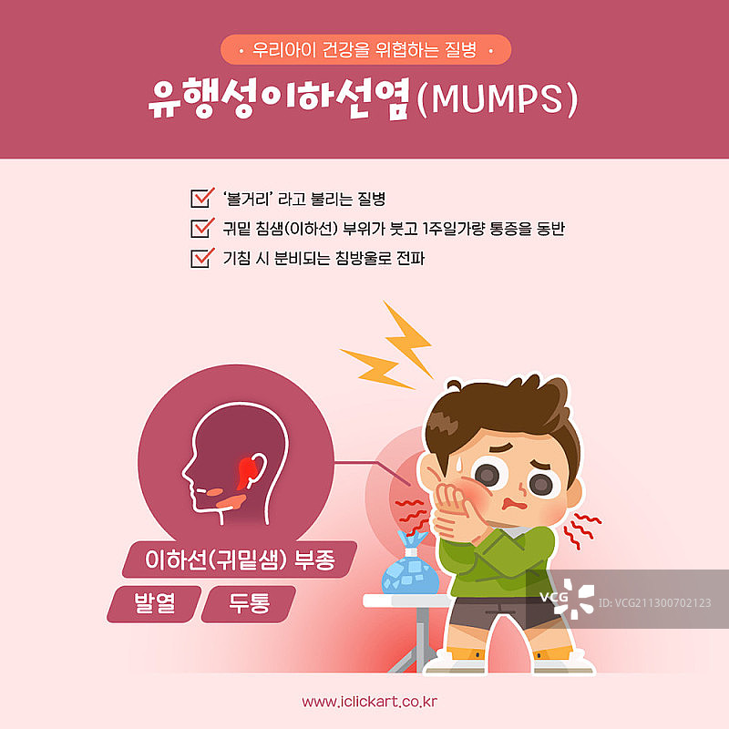 腮腺炎矢量插画图片素材