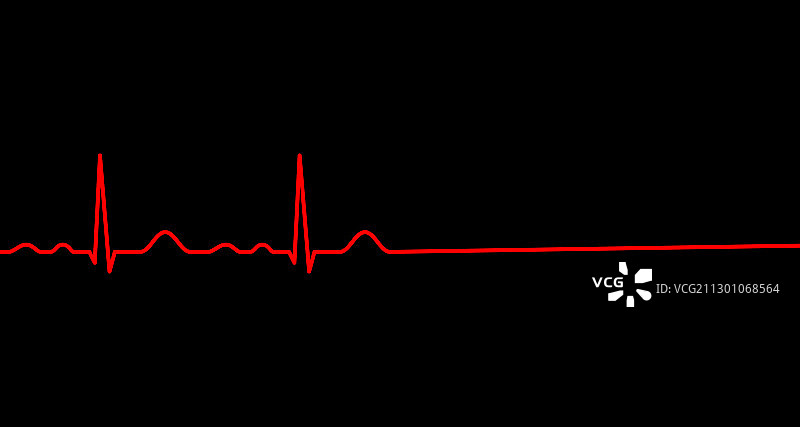心电图线心脏停止跳动死亡图片素材