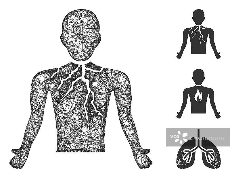 胸部肿瘤多边形网格图片素材