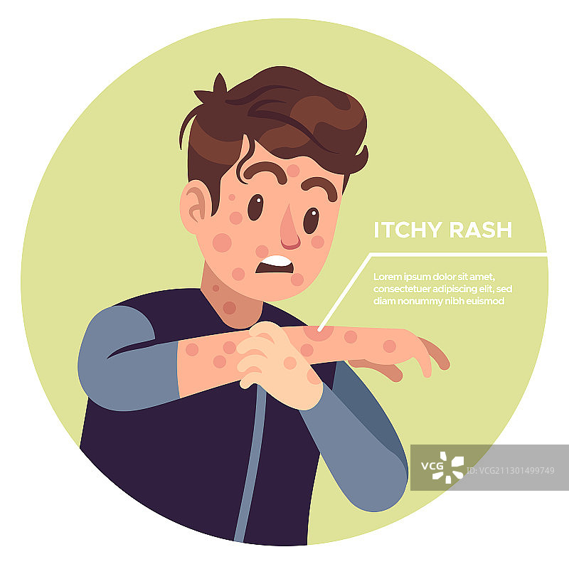 男人挠手臂过敏发炎图片素材