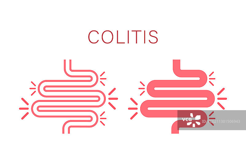 结肠炎胃肠道医疗图片素材