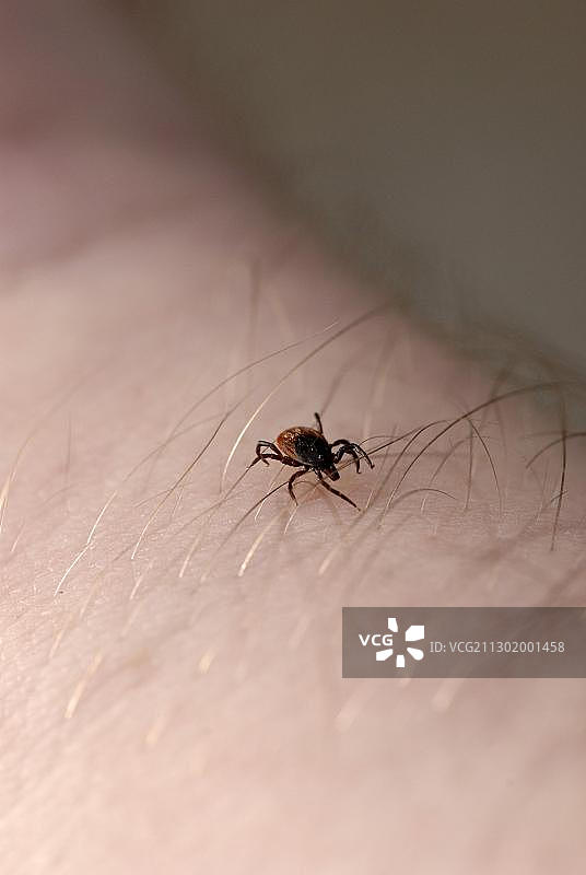 在皮肤上爬行的蜱虫图片素材