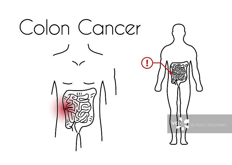 年轻男子结肠癌线性图标图片素材