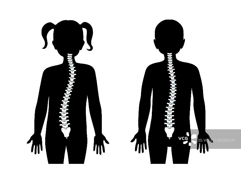 脊柱侧弯扁平风格图片素材