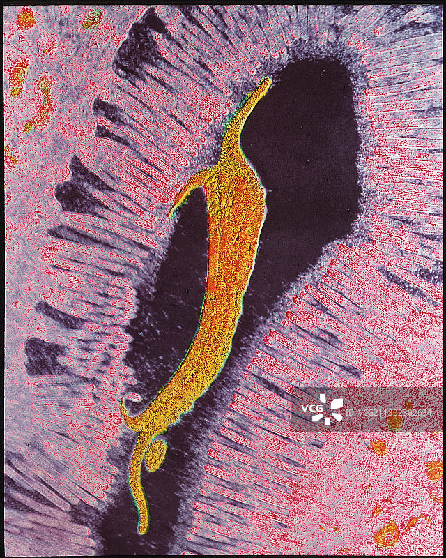 兰伯氏贾第鞭毛虫的透射电镜照片图片素材