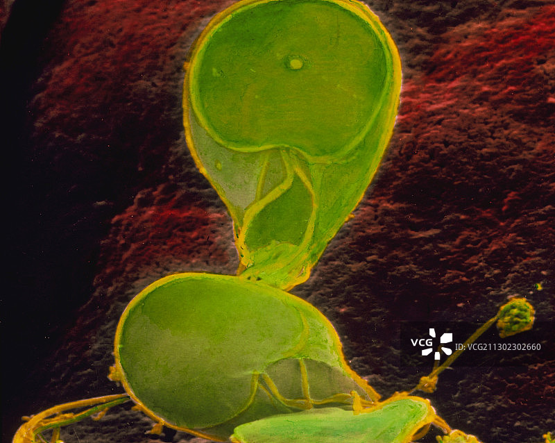 人肠道中贾第鞭毛虫的彩色扫描电镜图片素材