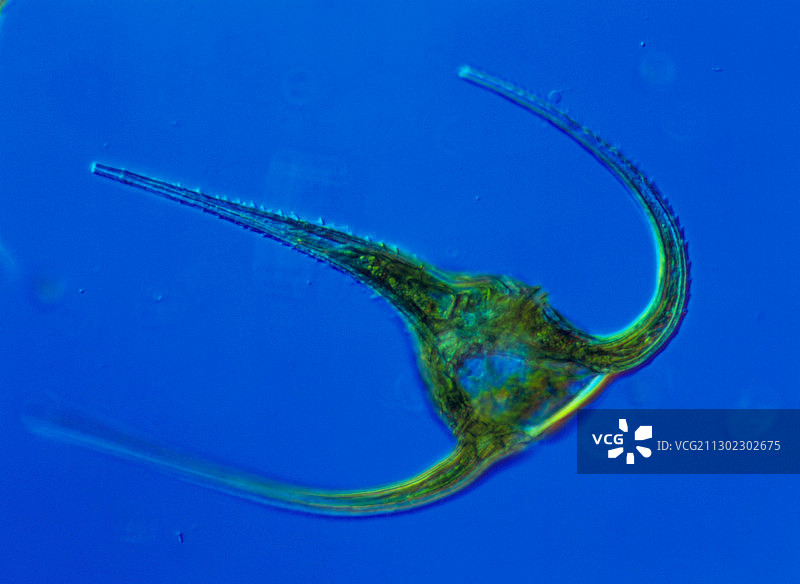 角甲藻属海洋甲藻的光学显微镜图像图片素材