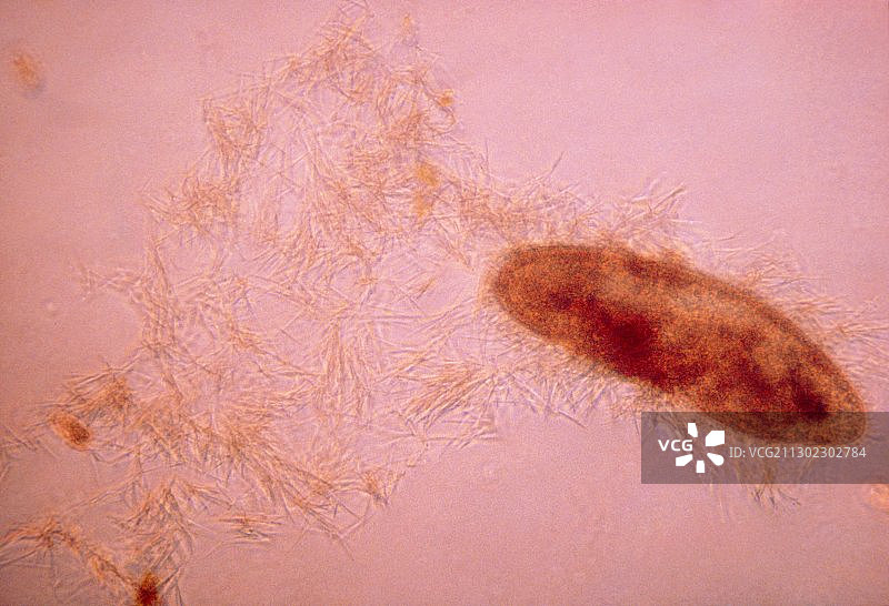 尾草履虫的显微镜照片图片素材