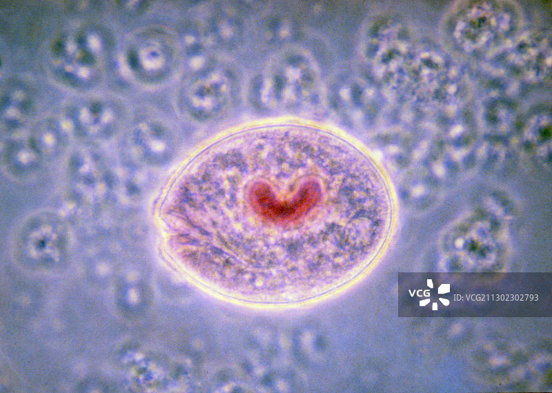 寄生原生动物结肠小袋虫光镜图图片素材