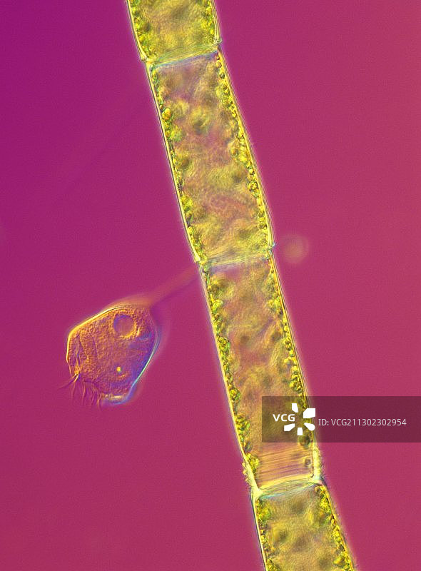 植物上的钟虫，光学显微照片图片素材