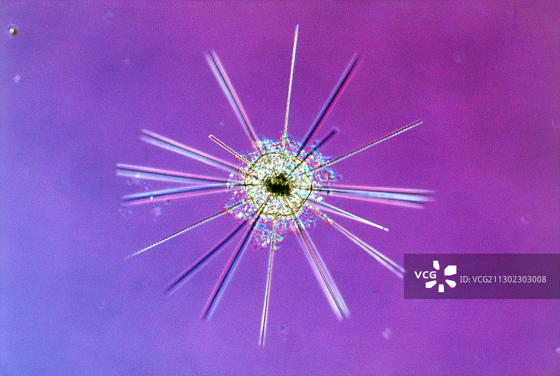 Acanthoplegma sp.棘虫的显微镜照片图片素材
