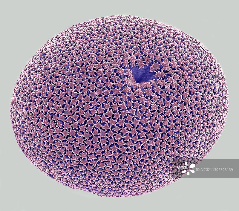 海绵骨针扫描电镜图图片素材