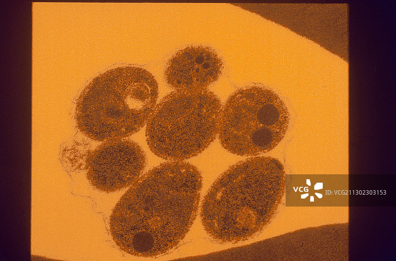 疟疾寄生虫的透射电镜图片素材