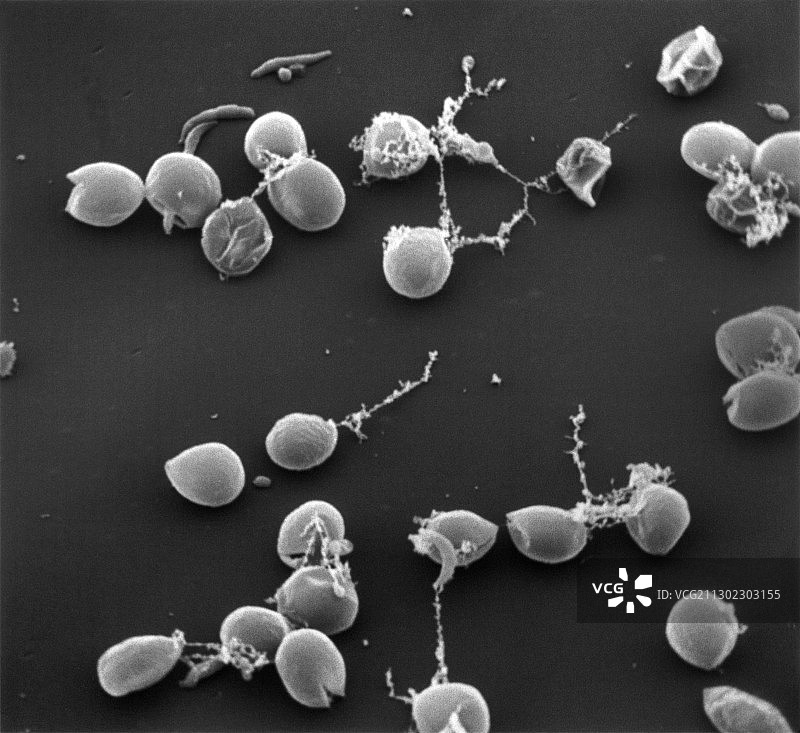 小隐孢子虫卵囊的扫描电镜图图片素材