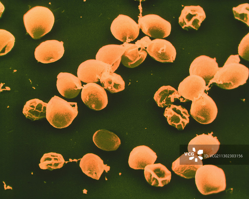 小隐孢子虫卵囊的彩色扫描电镜图图片素材