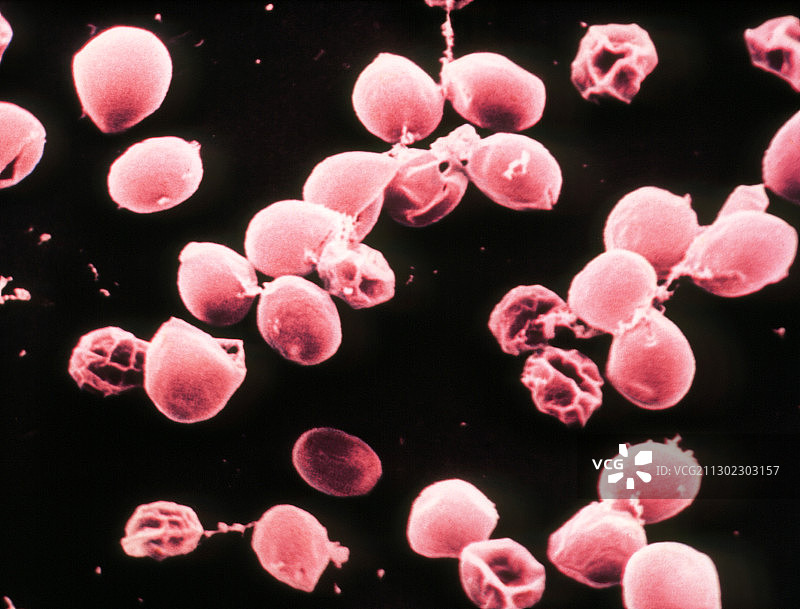 小隐孢子虫卵囊的彩色扫描电镜图图片素材