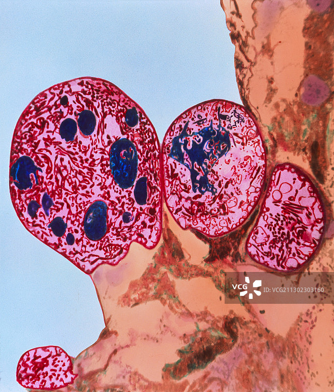 蚊子胃中的TEM疟原虫卵囊图片素材