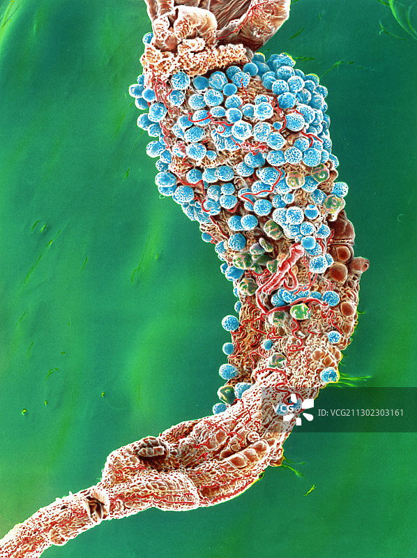 蚊子胃部的疟原虫卵囊扫描电镜图图片素材