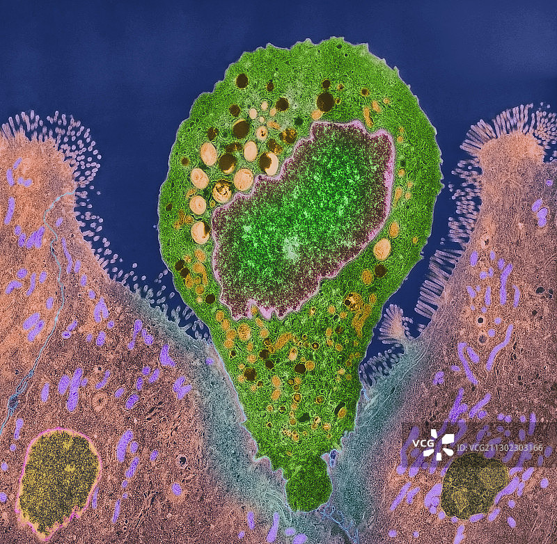 脑炎微孢子虫寄生虫，透射电镜图片素材