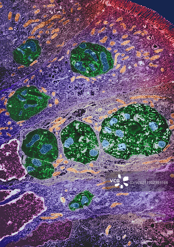 脑孢子虫，透射电镜图片素材