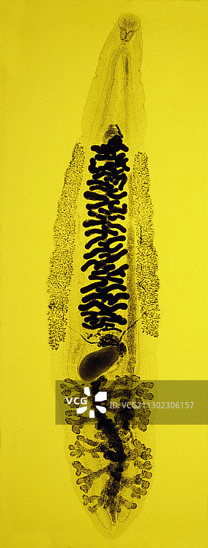 肝吸虫图片素材
