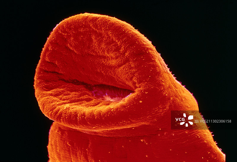 血吸虫头部和口器部分的扫描电镜图像图片素材