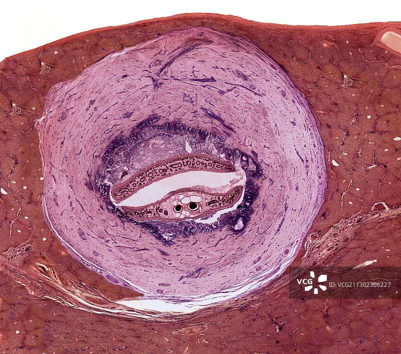 绵羊肝脏中的吸虫显微照片图片素材
