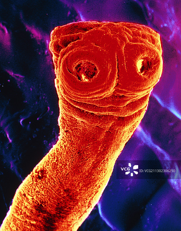 牛肉绦虫的扫描电子显微镜照片图片素材