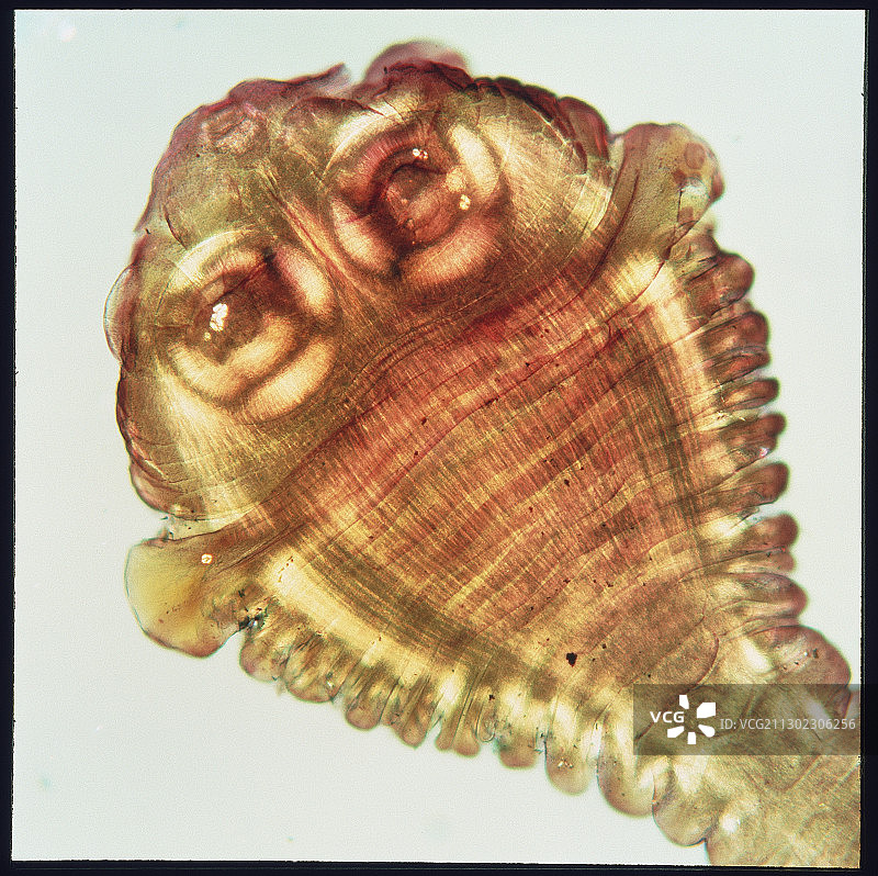 牛肉绦虫的头节图片素材