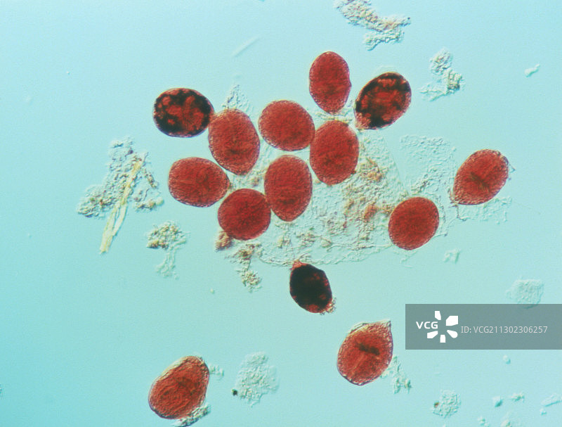 犬绦虫的囊尾蚴光镜图图片素材