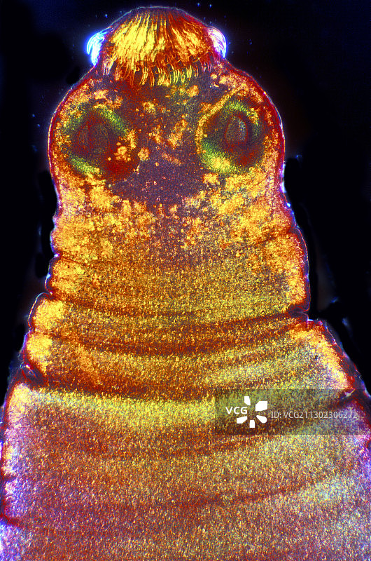 猪肉绦虫图片素材