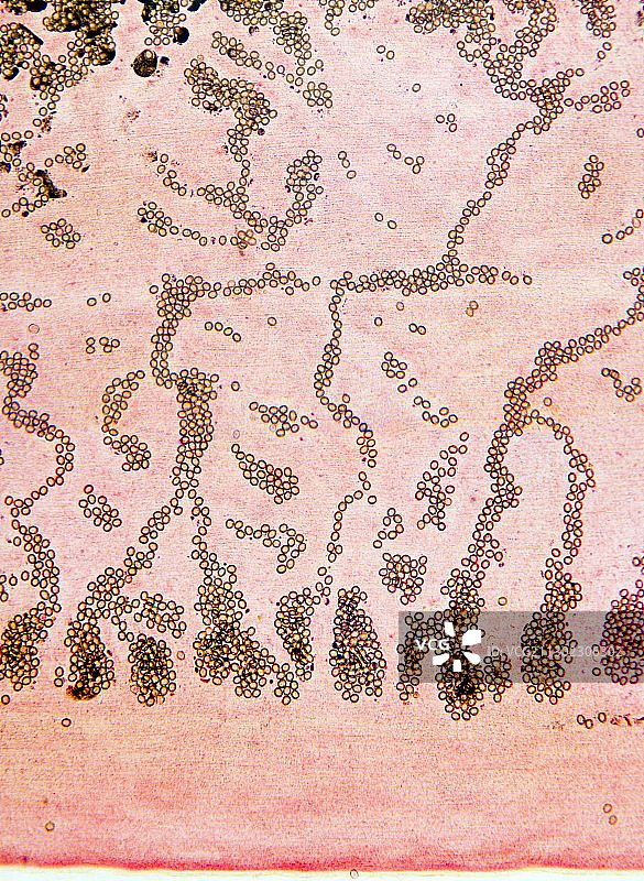 绦虫节片显微照片图片素材